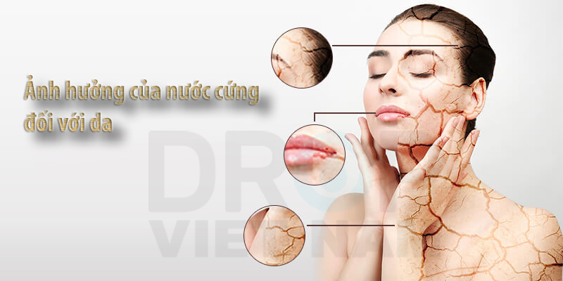 Nước cứng gây sạm da, khô da
