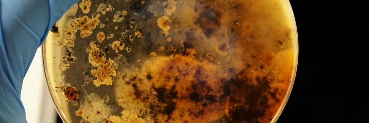 Thiết bị làm mềm nước có loại bỏ được vi khuẩn không?