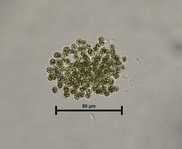 Microcystis dưới kính hiển vi
